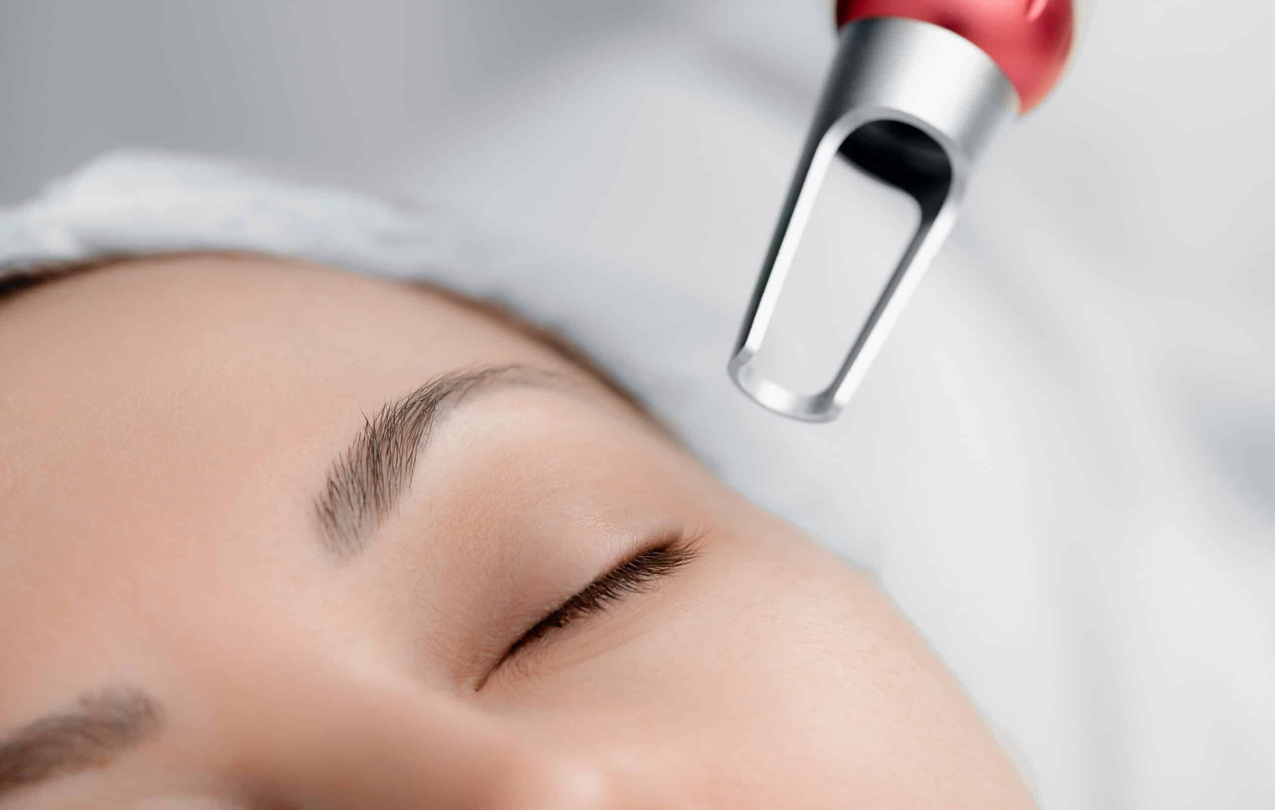 Pico Laser Benefits: The New Age in Skin Treatment Technology