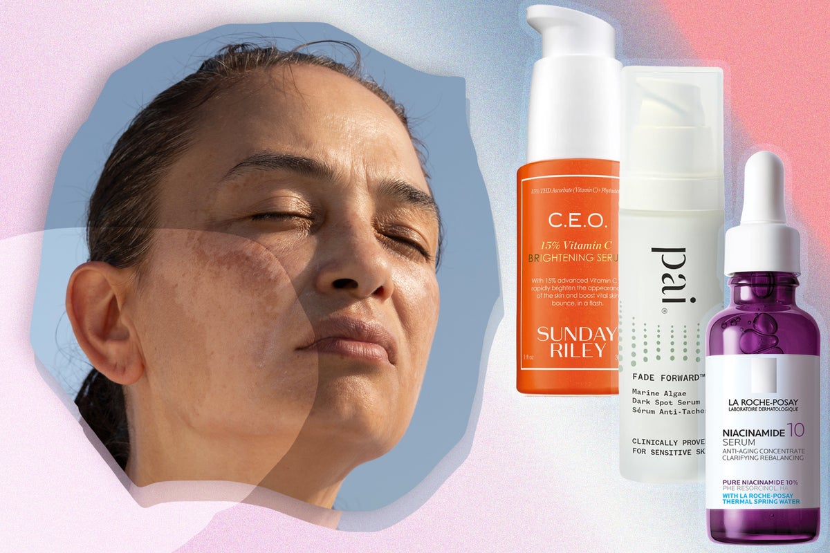 Dermatologist-Recommended Tips to Boost the Effectiveness of Hyperpigmentation Cream